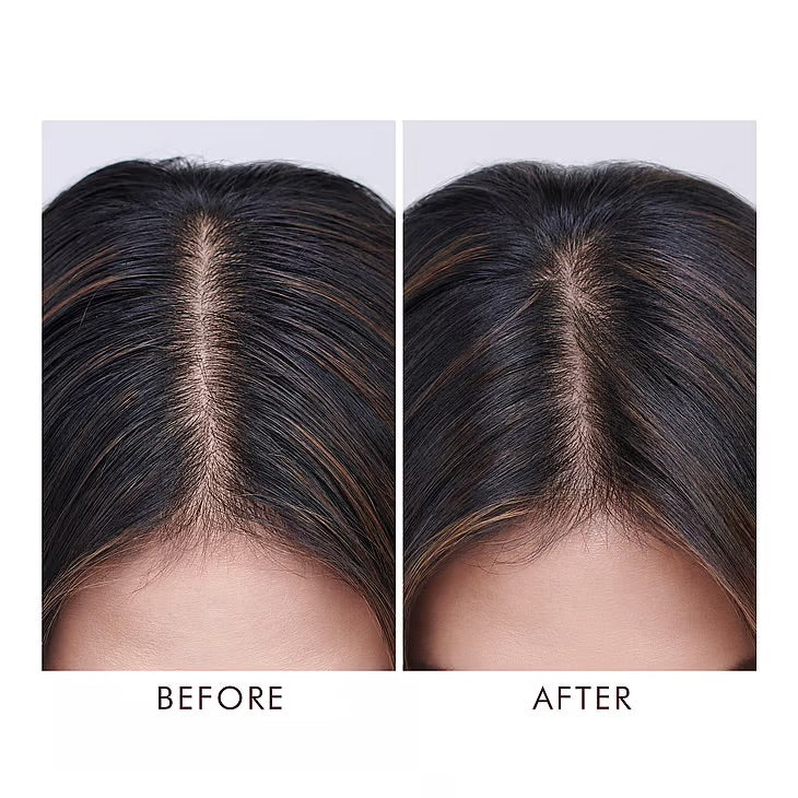 Oily Scalp Treatment